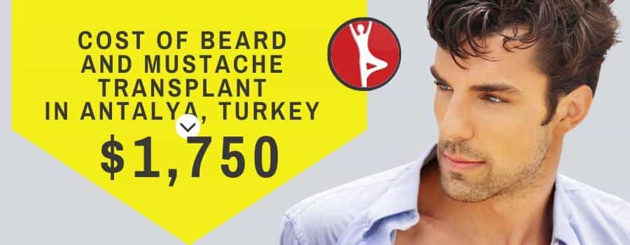 Cost of Beard and Mustache Transplant in Antalya Turkey